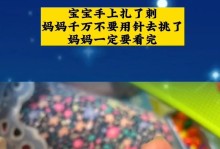 龙骨花刺扎手，怎么处理？（处理龙骨花刺刺伤的方法及注意事项）
