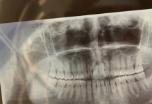 以门头沟区中医院看牙的优势与劣势剖析（中医院看牙的特色、服务项目与口碑评价）